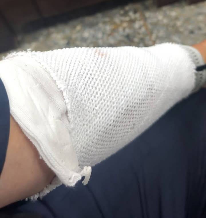 所長送醫包紮傷口，幸無大礙。翻攝畫面