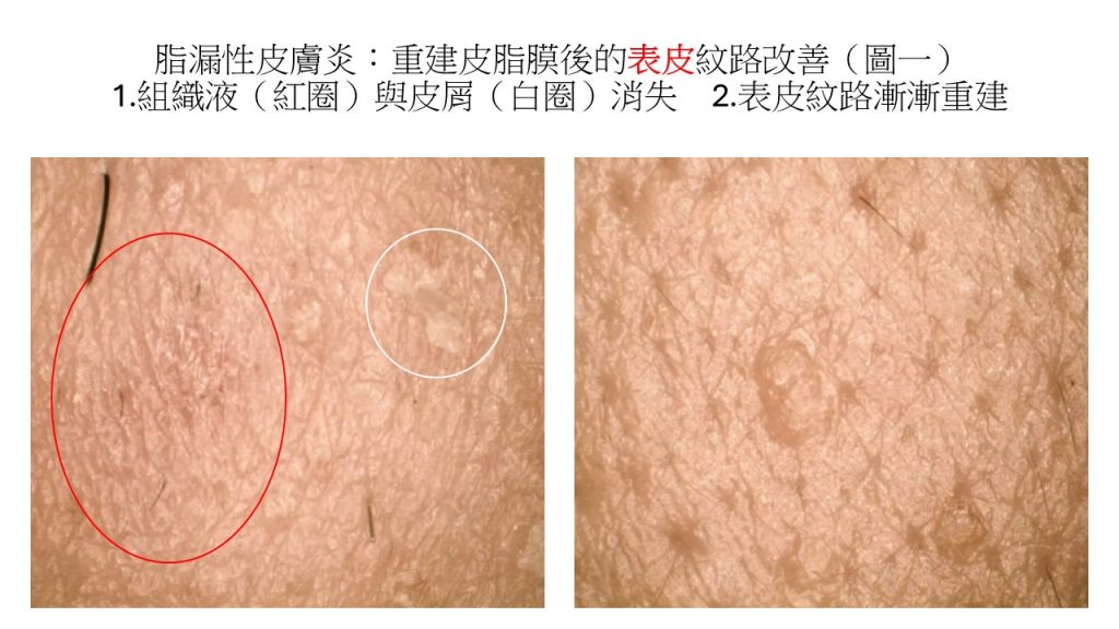 投影片1 - 報新聞 Mega News %E6%8A%95%E5%BD%B1%E7%89%871 1024x576 1