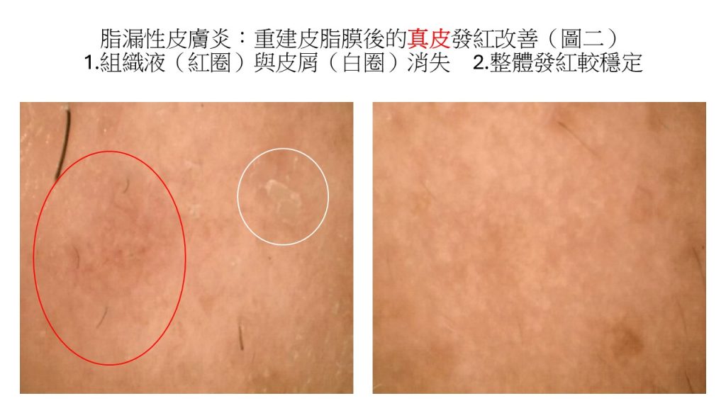 投影片2 - 報新聞 Mega News %E6%8A%95%E5%BD%B1%E7%89%872 1024x576 1