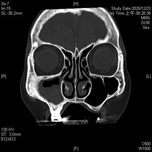%E5%9C%963%E6%9D%B1%E5%85%83%E7%B6%9C%E5%90%88%E9%86%AB%E9%99%A2%E8%80%B3%E9%BC%BB%E5%96%89%E7%A7%91%E8%A9%B9%E5%81%A5%E6%9A%98%E9%86%AB%E5%B8%AB%E5%88%A9%E7%94%A8%E9%BC%BB%E7%AB%87%E5%85%A7%E8%A6%96%E9%8F%A1%E5%BE%AE%E5%89%B5%E6%89%8B%E8%A1%93%E9%96%8B%E6%93%B4%E9%BC%BB%E7%AB%87%E9%96%8B%E5%8F%A3%E5%BE%B9