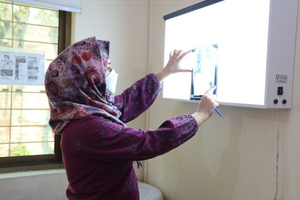 在巴基斯坦無國界醫生支援的「抗藥性結核病計畫式管理」據點，Hafsa Fatima醫師正在檢視病童的X光片。照片攝於2026年2月24日。©MSF