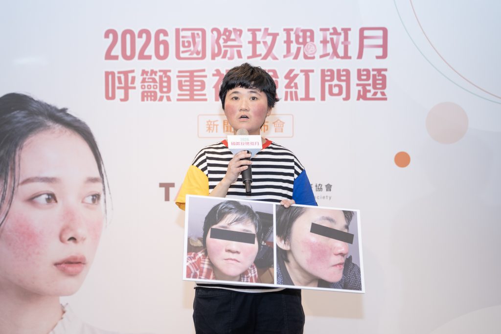 響應「2026國際玫瑰斑月」台灣青春痘暨玫瑰斑協會「臉紅認知與經驗調查」結果公布 4 %E6%96%B0%E8%81%9E%E7%85%A7%E7%89%87%E4%B8%89%E7%8E%AB%E7%91%B0%E6%96%91%E7%97%85%E5%8F%8B%E4%BB%A3%E8%A1%A8%E6%9E%97%E5%B0%8F%E5%A7%90 1024x683 1